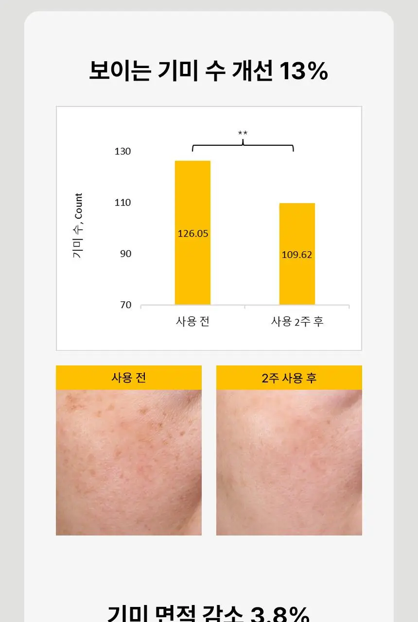 [2주만에기미감소16%] 쿠피 멜라스마 클리어 트라넥삼산 레몬수 기미크림 50ml 상세페이지 14